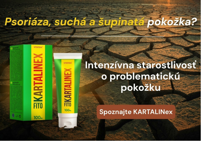 KARTALINex